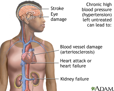 4 parts of the body impacted by high blood pressure - Vital Record