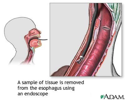 Esophageal tissue culture