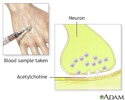 Cholinesterase test